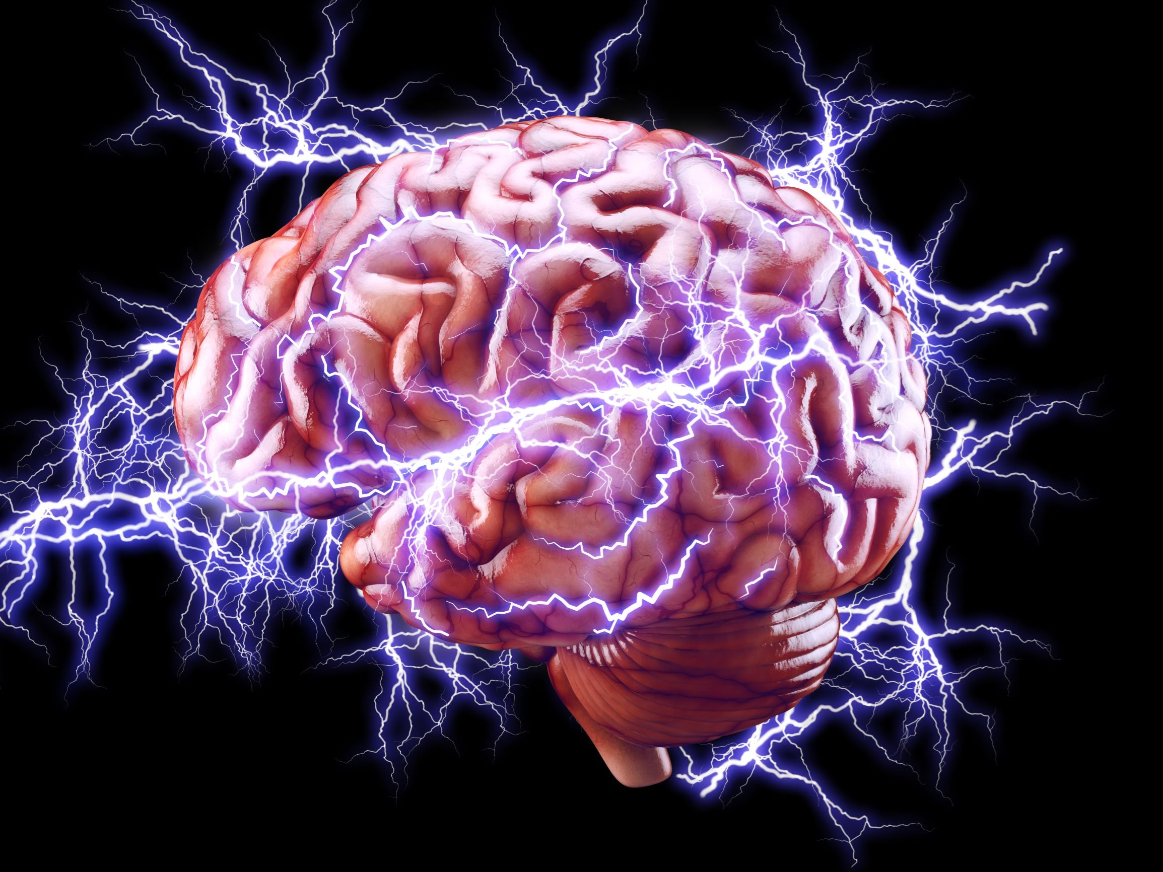 brain with electric sparks radiating out from it